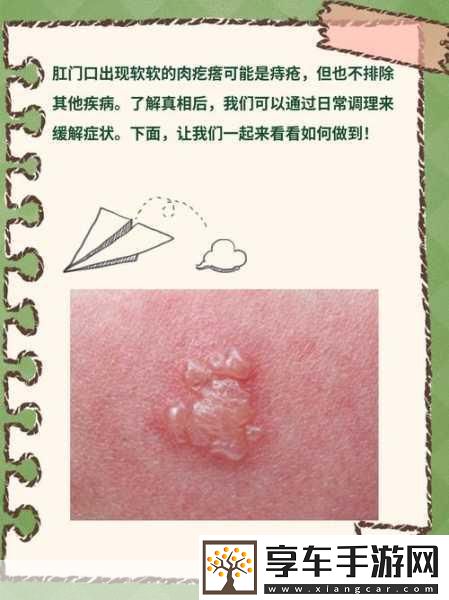 肛门口摸到个软软的肉要怎么消除-1.-如何解决肛门周围出现软块的问题